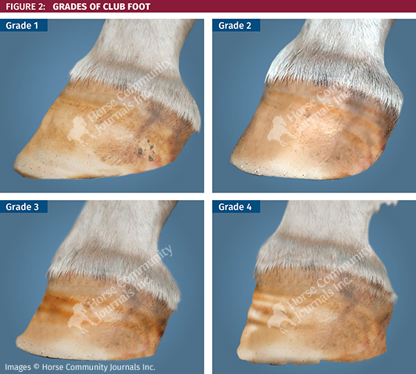 Recognizing And Managing The Club Foot In Horses Horse Journals